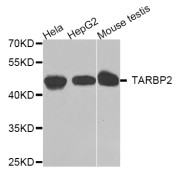 Western blot analysis of extracts of various cell lines, using TARBP2 antibody (abx006008) at 1/1000 dilution.