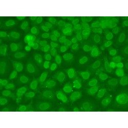 RISC-Loading Complex Subunit TARBP2 (TARBP2) Antibody