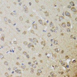 Chimerin 1 (CHN1) Antibody