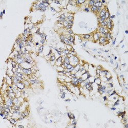 Chimerin 1 (CHN1) Antibody