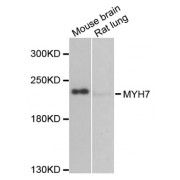 Western blot analysis of extracts of various cell lines, using MYH7 antibody (abx006013) at 1/1000 dilution.