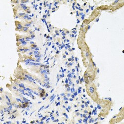 Myosin 7 (MYH7) Antibody