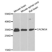 Western blot analysis of extracts of various cell lines, using CACNG4 antibody (abx006021) at 1/1000 dilution.