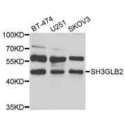 Western blot analysis of extracts of various cell lines, using SH3GLB2 antibody (abx006025) at 1/1000 dilution.