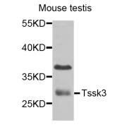 Western blot analysis of extracts of mouse testis, using TSSK3 antibody (abx006028) at 1/1000 dilution.