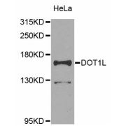 Western blot analysis of extracts of HeLa cells, using DOT1L antibody (abx006032) at 1/1000 dilution.