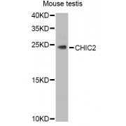 Western blot analysis of extracts of mouse testis, using CHIC2 Antibody (abx006049) at 1/1000 dilution.