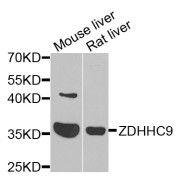 Western blot analysis of extracts of various cell lines, using ZDHHC9 antibody (abx006051) at 1/1000 dilution.