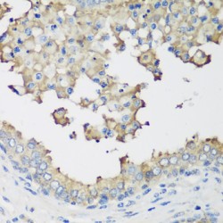 E3 Ubiquitin-Protein Ligase NEDD4-Like (NEDD4L) Antibody