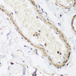 Caveolin 3 (CAV3) Antibody