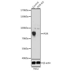 NADPH-Cytochrome P450 Reductase (POR) Antibody