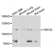Western blot analysis of extracts of various cell lines, using TRPC6 antibody (abx006081) at 1/1000 dilution.