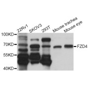 Western blot analysis of extracts of various cell lines, using FZD4 antibody (abx006084) at 1/1000 dilution.