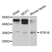 Western blot analysis of extracts of various cell lines, using STK16 antibody (abx006087) at 1/1000 dilution.