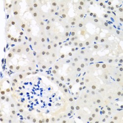 THO Complex 1 (THOC1) Antibody