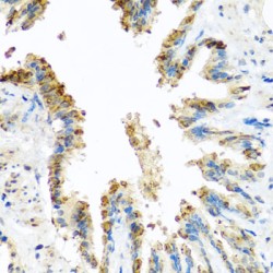 Branched Chain Alpha-Ketoacid Dehydrogenase Kinase (BCKDK) Antibody