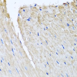 Tubulin-Tyrosine Ligase-Like Protein 12 (TTLL12) Antibody