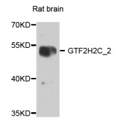 Western blot analysis of extracts of rat brain, using GTF2H2C_2 antibody (abx006118) at 1/1000 dilution.