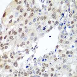 Pituitary Tumor Transforming 1 (PTTG1) Antibody