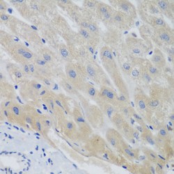 Pituitary Tumor Transforming 1 (PTTG1) Antibody