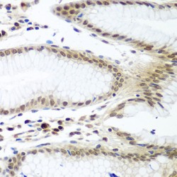 Pituitary Tumor Transforming 1 (PTTG1) Antibody