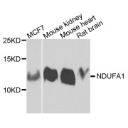 Western blot analysis of extracts of various cell lines, using NDUFA1 antibody (abx006127) at 1/1000 dilution.