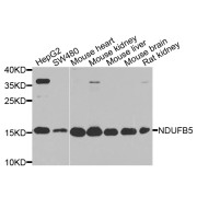 Western blot analysis of extracts of various cell lines, using NDUFB5 antibody (abx006128) at 1/1000 dilution.