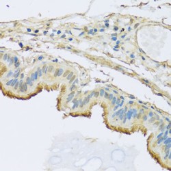 NADH Ubiquinone Oxidoreductase Subunit B5 (NDUFB5) Antibody