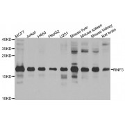 Western blot analysis of extracts of various cell lines, using RNF5 antibody (abx006132) at 1/1000 dilution.