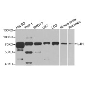 Western blot analysis of extracts of various cell lines, using IL4I1 antibody (abx006138) at 1/1000 dilution.