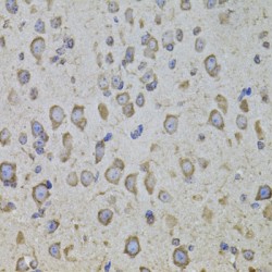 Corticotropin Releasing Hormone Receptor 1 (CRHR1) Antibody