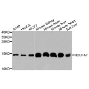 Western blot analysis of extracts of various cell lines, using NDUFA7 antibody (abx006153) at 1/1000 dilution.