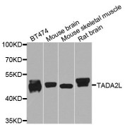 Western blot analysis of extracts of various cell lines, using TADA2A antibody (abx006160) at 1/1000 dilution.