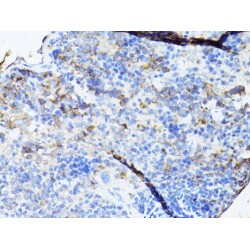 Transcription Elongation Factor, Mitochondrial (TEFM) Antibody