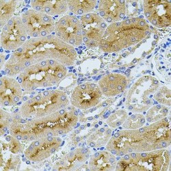 Transcription Elongation Factor, Mitochondrial (TEFM) Antibody