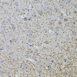 Transcription Elongation Factor, Mitochondrial (TEFM) Antibody