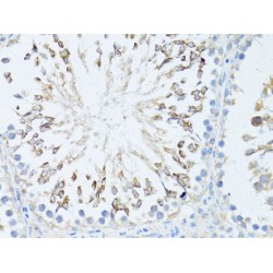 Transcription Elongation Factor, Mitochondrial (TEFM) Antibody