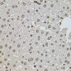 Zinc Finger Protein 408 (ZNF408) Antibody