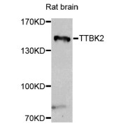 Western blot analysis of extracts of rat brain, using TTBK2 antibody (abx006182) at 1/1000 dilution.