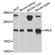 Western blot analysis of extracts of various cell lines, using ARL6 antibody (abx006186) at 1/1000 dilution.