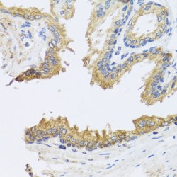 ADP-Ribosylation Factor-Like Protein 6 (ARL6) Antibody