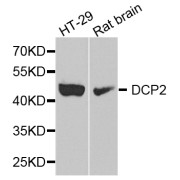 Western blot analysis of extracts of various cell lines, using DCP2 antibody (abx006187) at 1/1000 dilution.