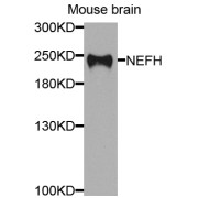 Western blot analysis of extracts of mouse brain, using NEFH antibody (abx006203) at 1/1000 dilution.