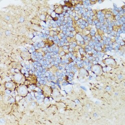 Neurofilament Heavy Polypeptide (NEFH) Antibody