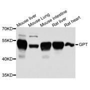 Western blot analysis of extracts of various cell lines, using GPT antibody (abx006217) at 1/1000 dilution.