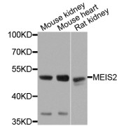 Western blot analysis of extracts of various cell lines, using MEIS2 antibody (abx006231) at 1/1000 dilution.