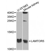 Western blot analysis of extracts of various cell lines, using LAMTOR5 antibody (abx006239) at 1/1000 dilution.