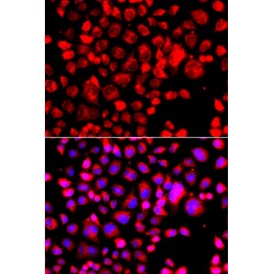 Eotaxin 1 (CCL11) Antibody