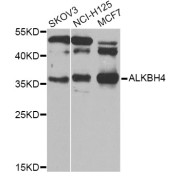 Western blot analysis of extracts of various cell lines, using ALKBH4 Antibody (abx006246) at 1/1000 dilution.