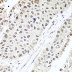 AlkB Homolog 4, Lysine Demethylase (ALKBH4) Antibody